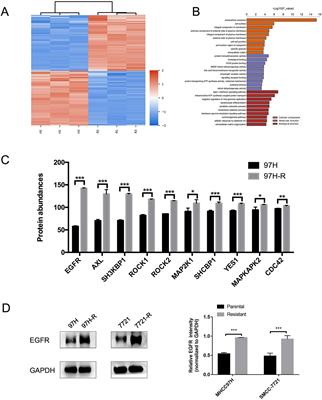 EGFR bypass activation mediates acquired resistance to regorafenib in hepatocellular carcinoma